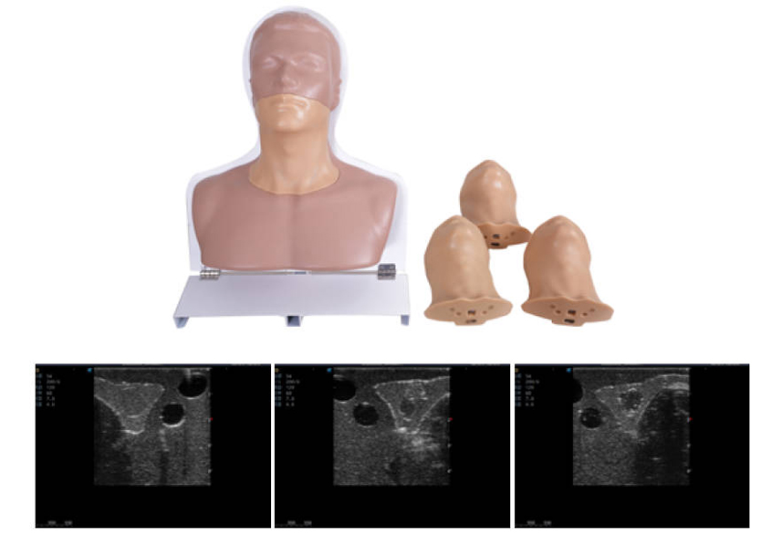 甲状腺超声检查平台 2.0